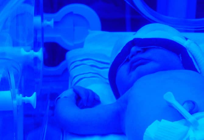 Preemie Babies – My Journey – Part 1