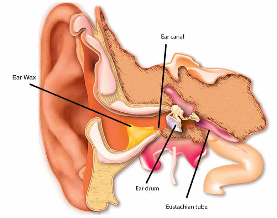 ear-wax-1